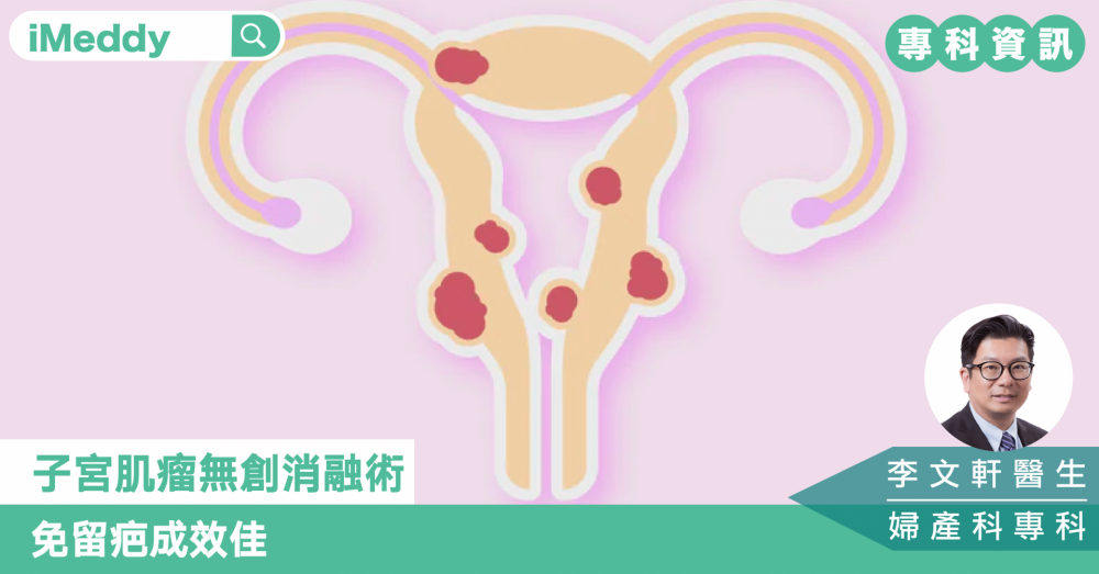 子宮肌瘤無創消融術 免留疤成效佳